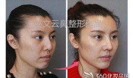 新疆整形爆料案件最新进展,真相逐步浮出水面