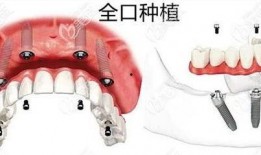 佛山种牙爆料事件最新情况